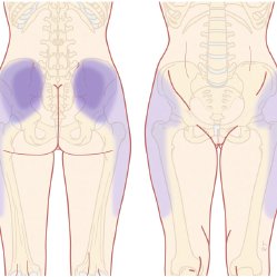 Lumbar Facet Referral Patterns