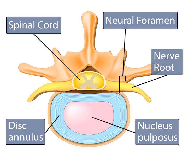 You are currently viewing Do Chiropractors Treat Disc Herniations?